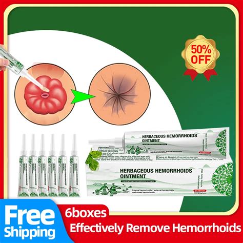 17 Impressive Hemorrhoid Relief It Works Ideas External Hemorrhoids