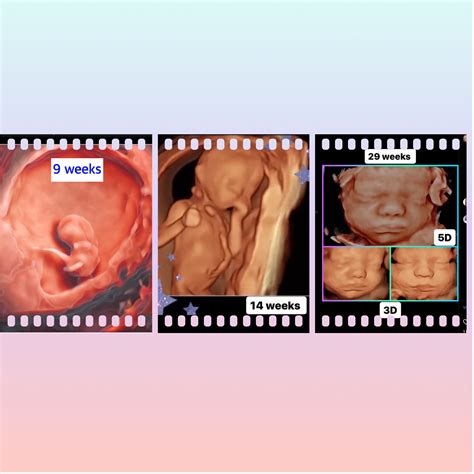 3D 4D 5D Hd Baby Ultrasound Imaging Gender Ultrasound Sonogram Bebe