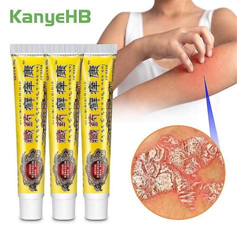 3Pcs Psoriasis Skin Ointment Treat Dermatitis Rash Mosquito Bites