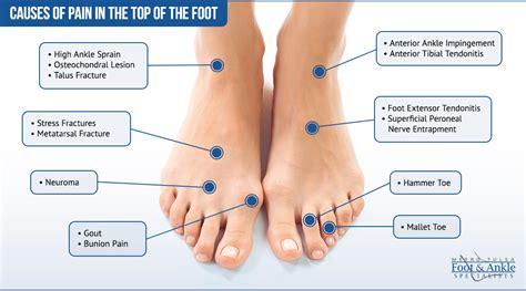 6 Conditions That Cause Pain On Top Of The Foot Near The Ankleborder