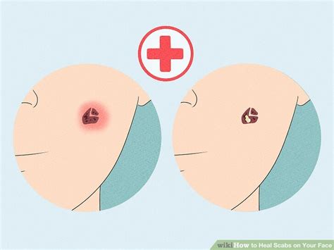7 Ways To Heal Scabs On Your Face Wikihow