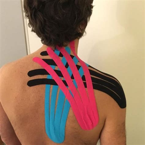 77 Best Kinesiology Tape Shoulder Images On Pinterest Kinesiology
