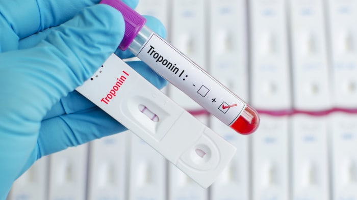 A Brief Review Of Troponin Testing For Clinicians American College Of