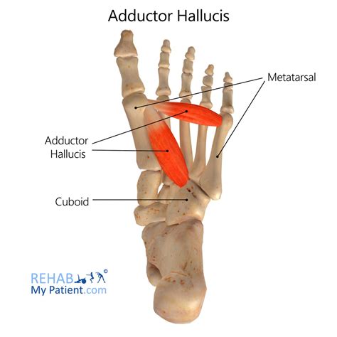 Abductor Hallucis Pain