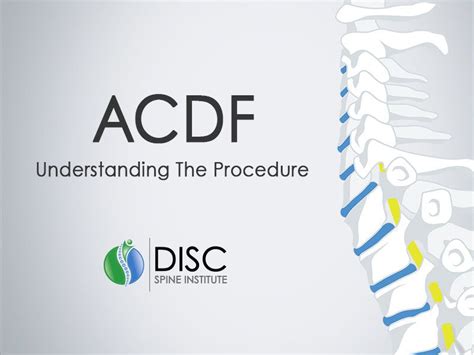 Acdf Surgery Six Things You Should Know Disc Spine Institute Tx