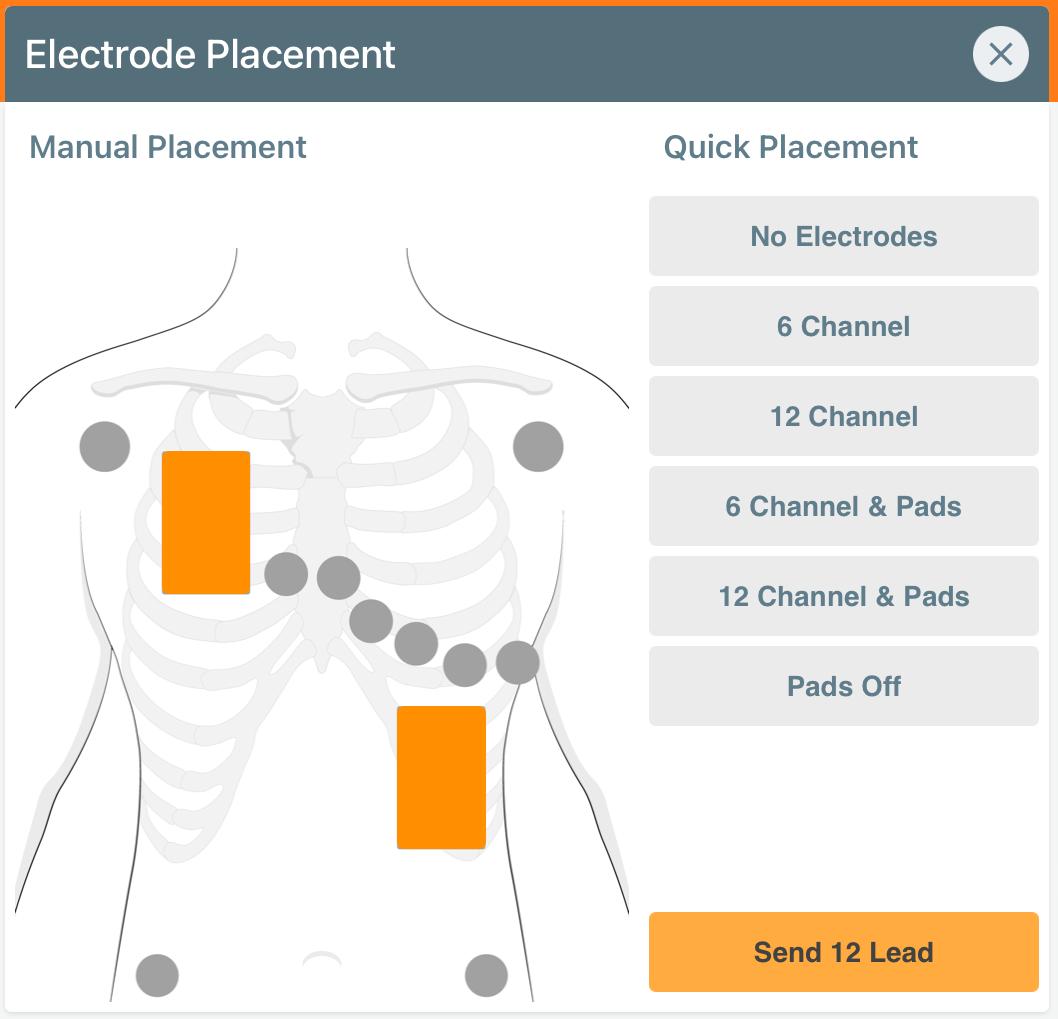 Aed Pad Placement