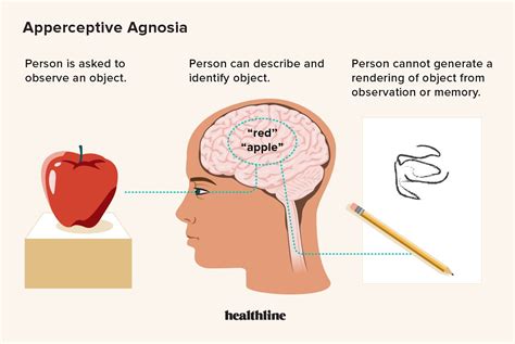 Agnosia