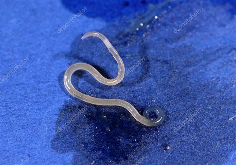 Anisakis Simplex Herring Worm Stock Photo Pmaracena 10717663