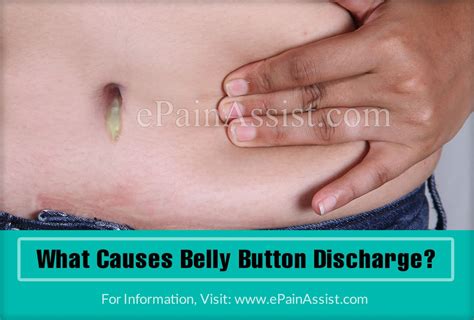 Belly Button Discharge Causes Treatments And More