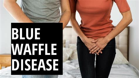 Blue Waffles Disease A Complete Guide To The Blue Waffle Std Youtube