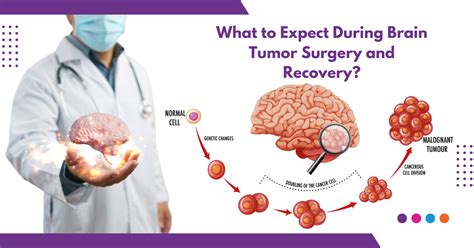5 Brain Tumor Surgery Tips