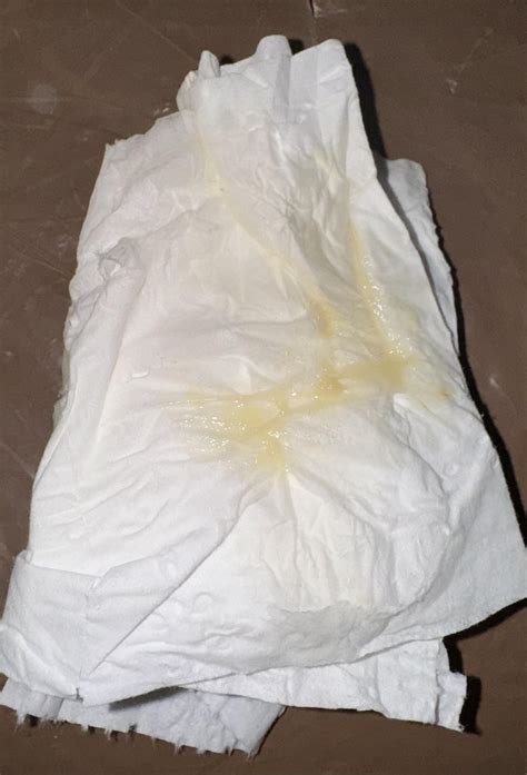 Bright Yellow Discharge