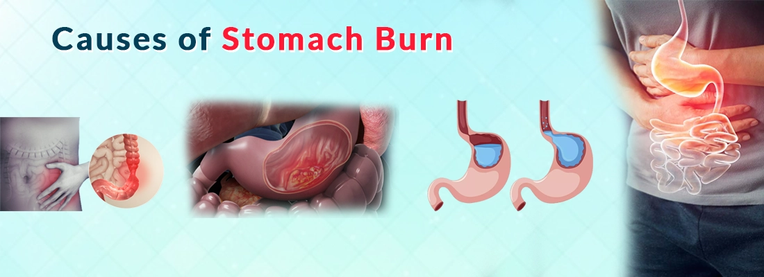 Burning Stomach Pain In The Morning Burning Stomach Pain Causes