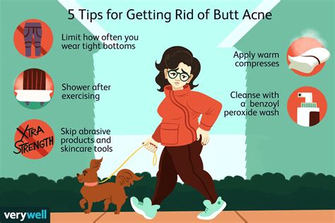 Butt Acne What Causes It And How To Get Rid Of It