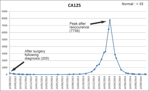Ca 125 Levels Chart Ponasa