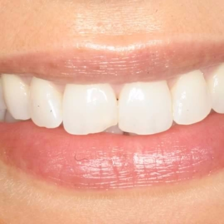 Campus Dental Plan Top Rated Ucla Westwood Dentist Best Reviewed