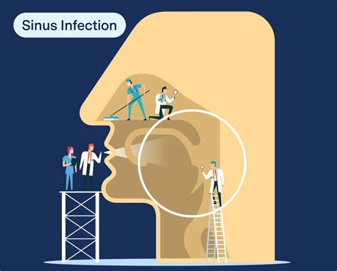 Can A Sinus Infection Cause Tooth Pain In Front Teeth General