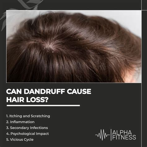 Can Dandruff Cause Hair Loss Alphafitness