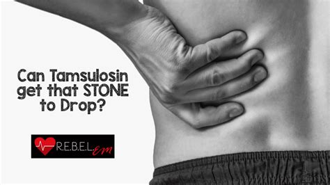 Can Tamsulosin Get That Stone To Drop Rebel Em Emergency Medicine Blog