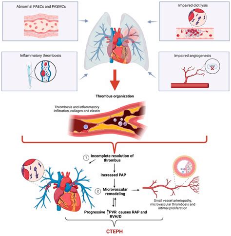 Chronic Thromboembolic Pulmonary Hypertension Cteph Heart