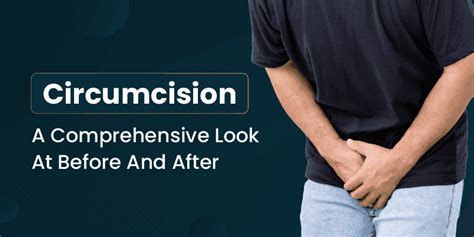 Circumcision Before And After Adult