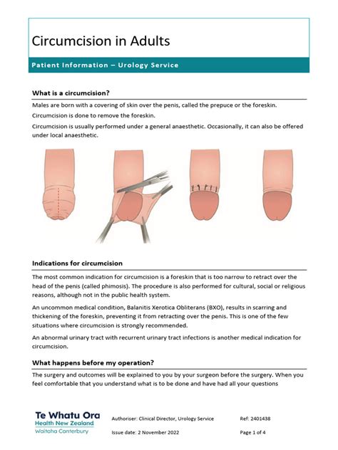 Circumcision For Adults