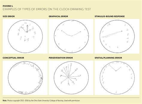 Clock Drawing Test Results Drawings Of Love
