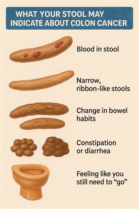 Colon Cancer Stool Shape