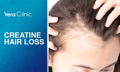 Creatine Hair Loss Is There A Link Aroleap