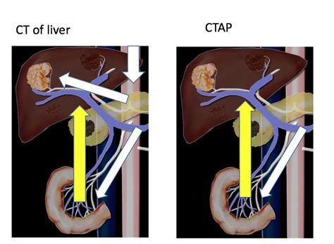 Ctap Medical Abbreviation