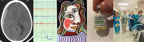 Delirium Emcrit Project