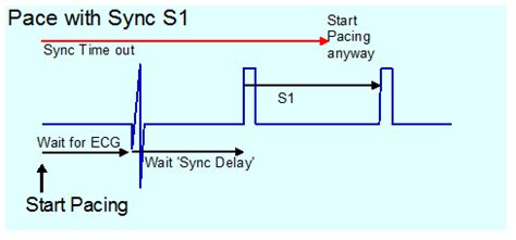 Demo Topic Diagnostic Pacing