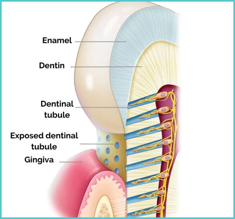 Dentosphere World Of Dentistry Tooth Sensitivity Dentin