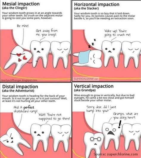 Discover 5 Interesting Truths About Wisdom Teeth Grey Street Dentist