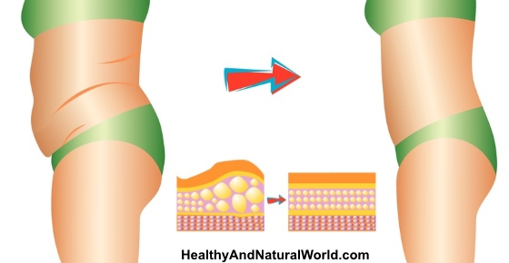 Doctors Explain How To Lose Belly Fat Without Exercise Power Of