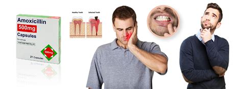 Does Amoxicillin Help Treat Tooth Infections And Pain