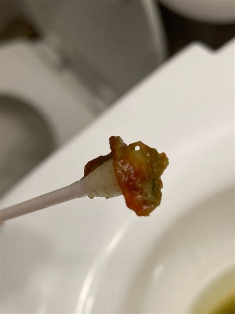 Does Watermelon Make You Poop