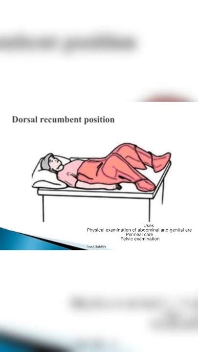 Dorsal Recumbent Position Image Based Mcq S For Aiims 2023 Youtube