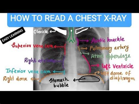 Easy Notes On Heart Learn In Just 4 Minutes