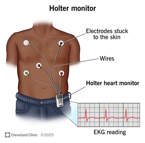 Ecg Holter Monitor System Sterling Medical Devices