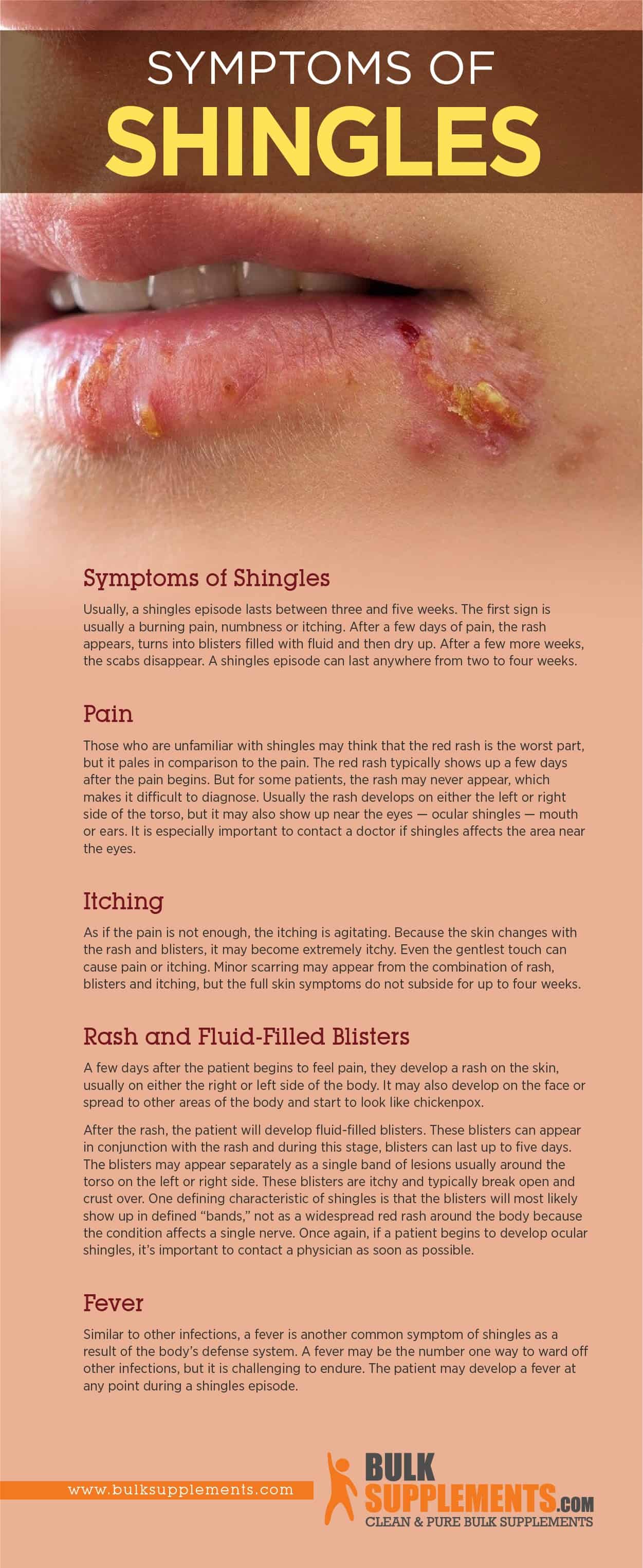 Eczema Vs Shingles Symptoms Causes And Treatment
