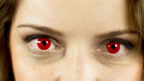 Eyes Always Red After Wearing Contacts At James Bailey Blog