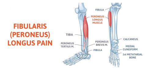 Fibularis Longus Pain Needs To Be Properly Evaluated