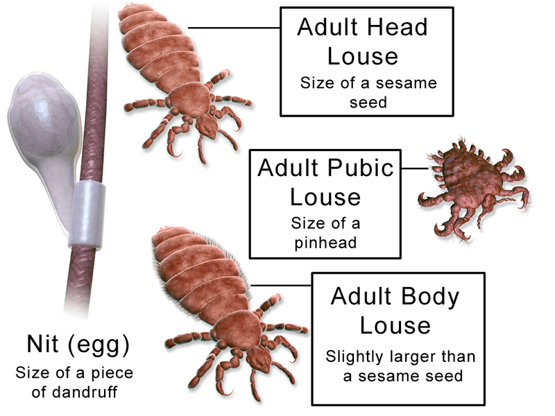 Fleas Vs Lice Understanding The Difference Between Lice And Fleas