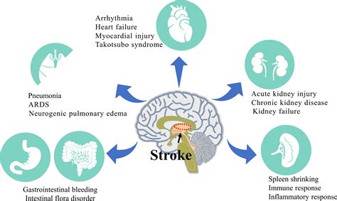 Frontiers Peripheral Organ Injury After Stroke