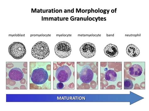 General Diagnostics Immature Granulocytes Absolute