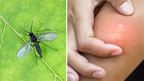 Gnat Bites On Humans