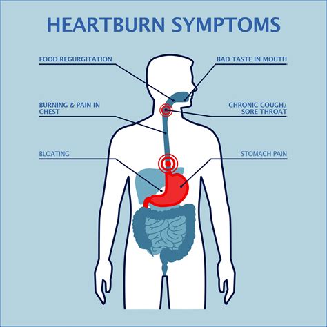 Heartburn After Car Accident At Joseph Busch Blog