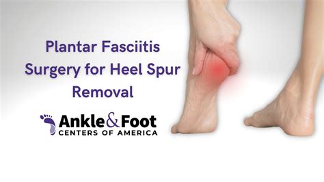 Heel Spur Surgery