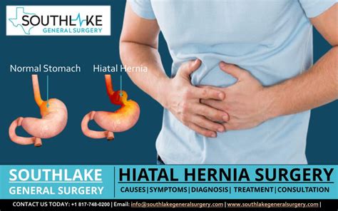 Hiatal Hernia Surgery Recovery Time Maryland Bariatrics
